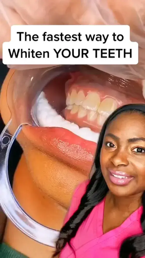 Your Journey to a Whiter Smile Begins Now