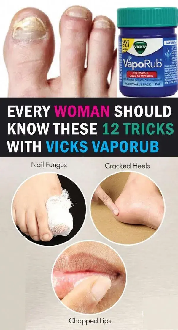 Every Woman Should Know These 12 Tricks With Vicks VapoRub