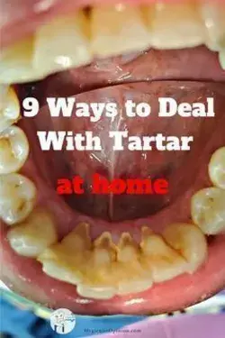 How to treat tartar at home in 2022 all naturally.