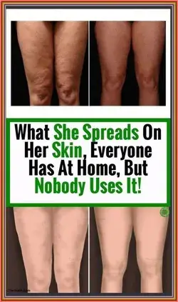 WHAT SHE SPREADS ON HER SKIN, EVERYONE HAS AT HOME � BUT NOBODY USES IT!