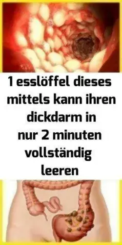 😍Möchten Sie in 10 Tagen leicht 7 kg abnehmen?😍