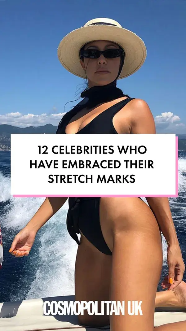 12 celebrities who have embraced their stretch marks