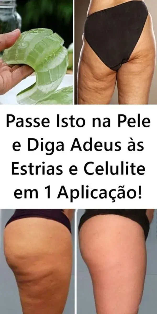 Passe Isto na Pele e Diga Adeus às Estrias e Celulite em 1 Aplicação!