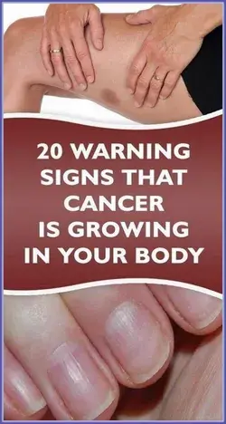 20 Warning Signs that Cancer is Growing in Your Body