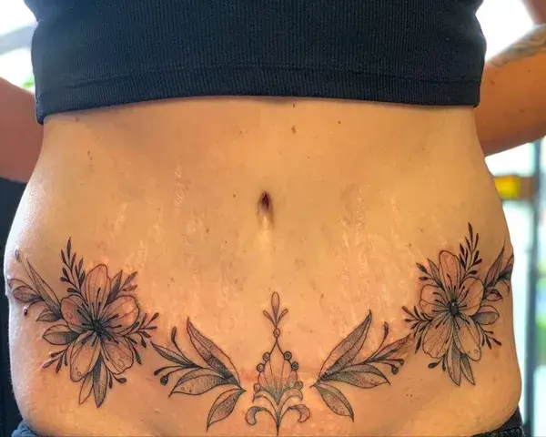 Tummy tuck tattoo