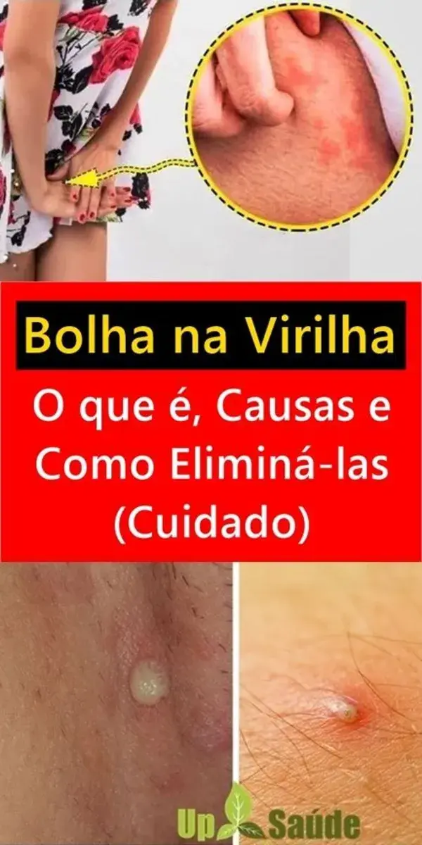 Virilha Inchada e Dolorida? Veja a Causa e o que Fazer!