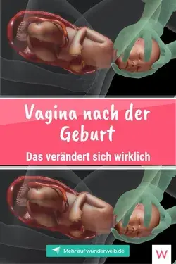 Vagina nach Geburt: Was verändert sich?