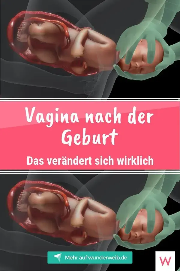 Vagina nach Geburt: Was verändert sich?