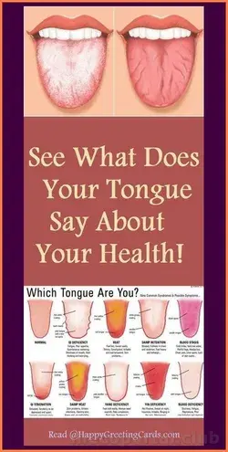 WHAT DOES YOUR TONGUE SAY ABOUT YOUR HEALTH?