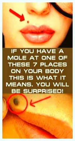 IF YOU HAVE A MOLE AT ONE OF THESE 7 PLACES ON YOUR BODY THIS IS WHAT IT MEANS-YOU WILL BE SURPRISED