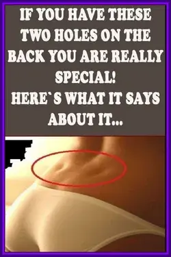 IF YOU HAVE THESE TWO HOLES ON THE BACK YOU ARE REALLY SPECIAL! HERE?S WHAT IT SAYS ABOUT YOU?