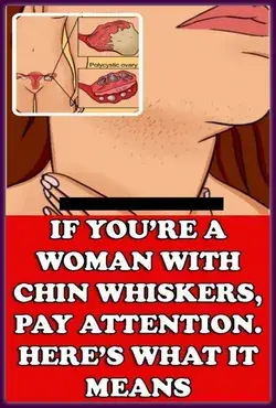 If You Are a Woman With Chin Whiskers, Pay Attention. Here�s What It Means!