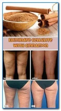 HOW TO GET RID OF CELLULITE: 10 NATURAL REMEDIES THAT WORK
