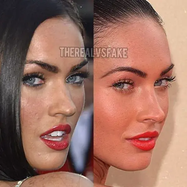 Megan Fox: Before & After Nose Job