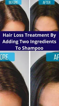 Hair Loss Treatment By Adding Two Ingredients To Shampoo