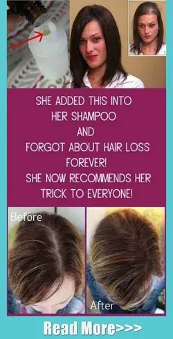 She Added This to Her Shampoo and Stopped Losing Hair (Now, She Recommends Her Trick to