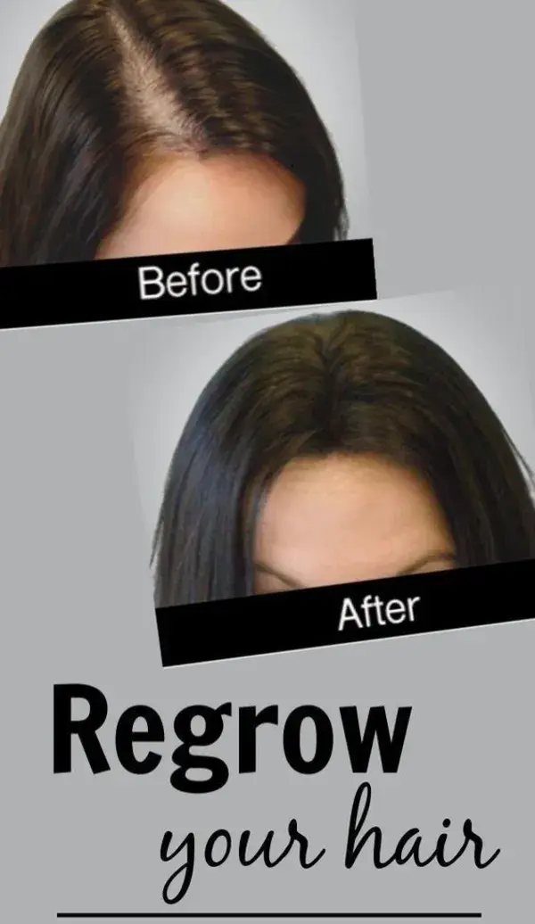 hair regrowth