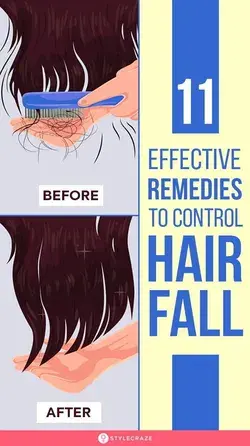 11 Effective Home Remedies And Tips To Control Hair Fall