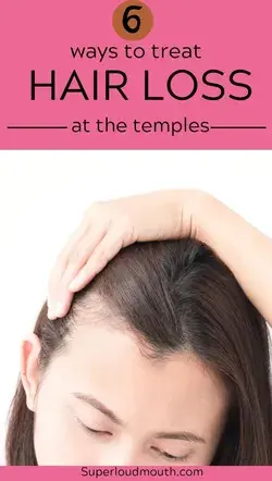 How to treat Temple Hair Loss with Home remedies