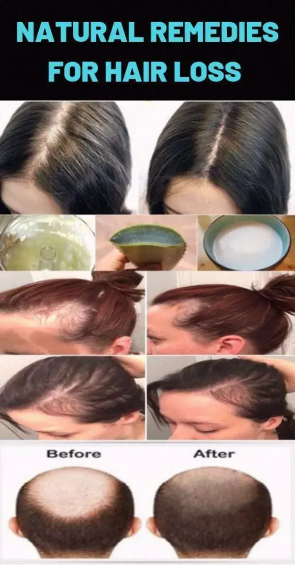 hair fall solution, hair loss