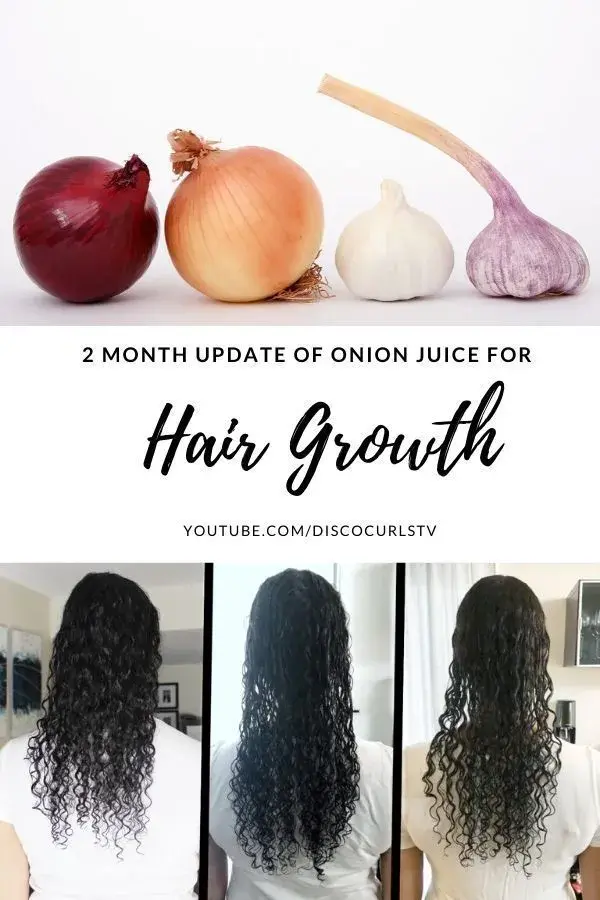 Onion Juice for HAIR GROWTH & SHEDDING (2 Month Update) | DISCOCURLSTV