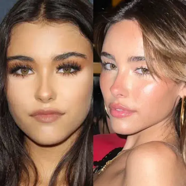 Madison Beer plastic surgery