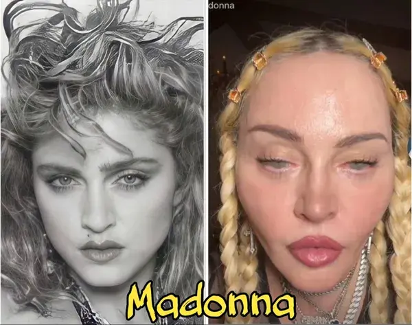 Madonna