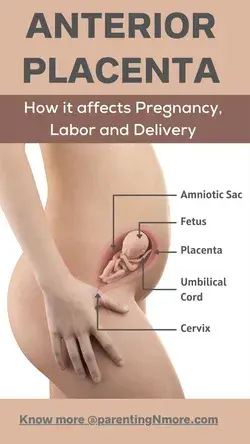 Anterior Placenta Position – How It Affects Pregnancy, Labor and Delivery