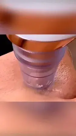 Electric Blackhead Remover!!