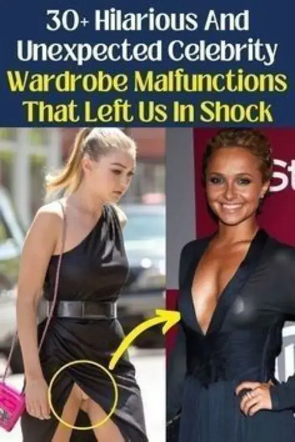 Hilarious And Unexpected Celebrity Wardrobe Malfunctions