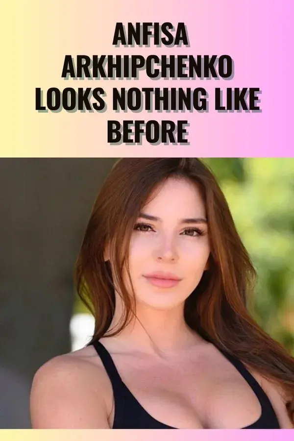 Anfisa Arkhipchenko Looks Nothing Like Before