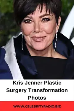 Kris Jenner Plastic Surgery Transformation Photos