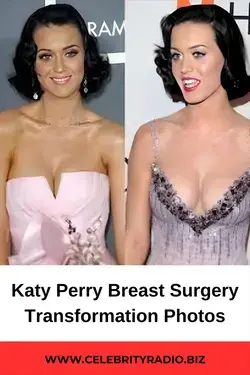 Katy Perry Breast Surgery  Transformation Photos