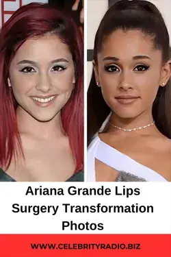 Ariana Grande Lips  Surgery Transformation Photos