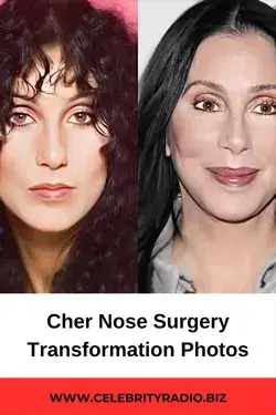 Cher Nose Surgery Transformation Photos