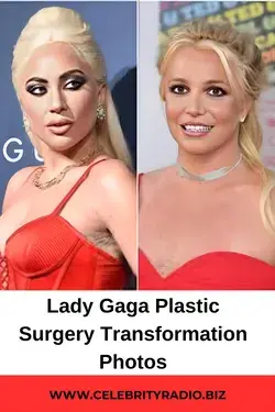 Lady Gaga Plastic Surgery Transformation Photos