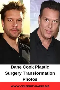 Dane Cook Plastic Surgery Transformation Photos