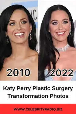 Katy Perry Plastic surgery Transformation Photos