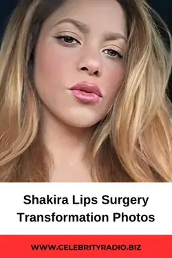 Shakira Lips Surgery Transformation Photos