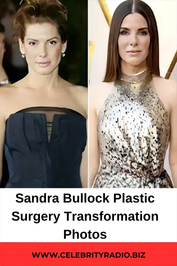 Sandra Bullock Plastic surgery Transformation photos