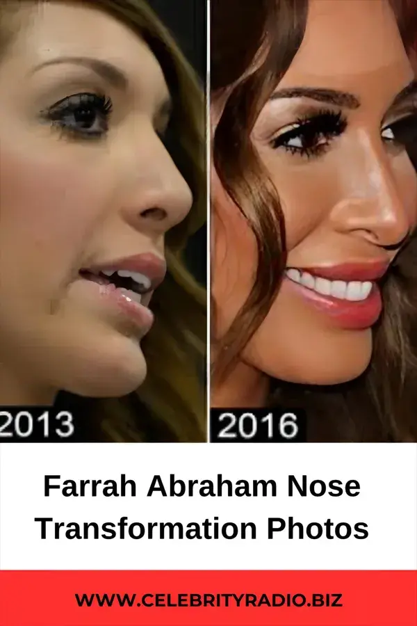 Farrah Abraham Nose Transformation photos