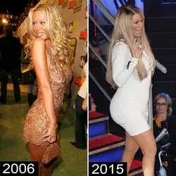 Celebrity before and after looks before she got a butt job
