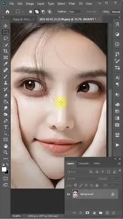 Remove Dark Circle Eyes