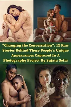 “Changing the Conversation”: 12 Raw Stories Behind These People’s Unique Appearances Captured