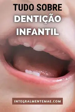 DENTIÇÃO INFANTIL: Tire suas dúvidas sobre o assunto aqui!