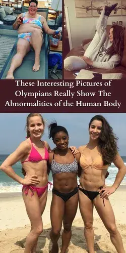 These Interesting Pictures of Olympians Really Show The Abnormalities of the Human Body