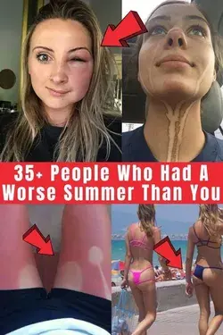 35+ People Who Had A Worse Summer Than You