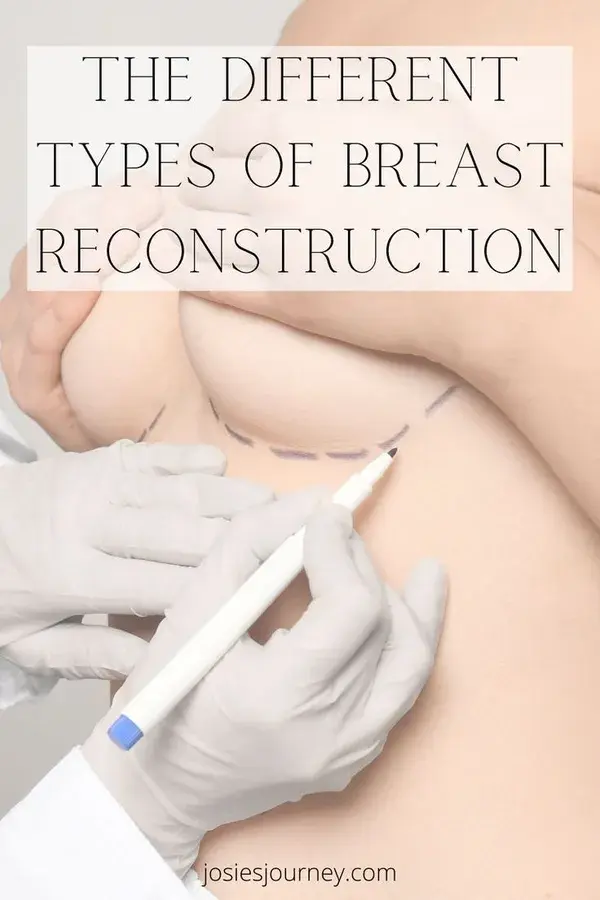 The Different Types of Breast Reconstruction