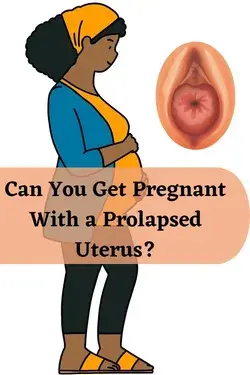 Can You Get Pregnant With a Prolapsed Uterus?