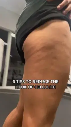 6 Tips to Reduce the Look of Cellulite